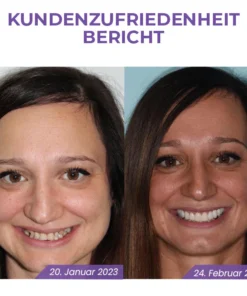 Fivfivgo™ Rein pflanzliches Zahnweiß-Mousse