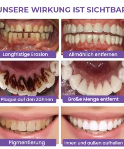 Fivfivgo™ Rein pflanzliches Zahnweiß-Mousse