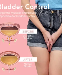 Fivfivgo™ UrinaGuard Anti-Inkontinenz-Gel