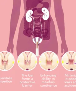 Fivfivgo™ UrinaGuard Anti-Inkontinenz-Gel