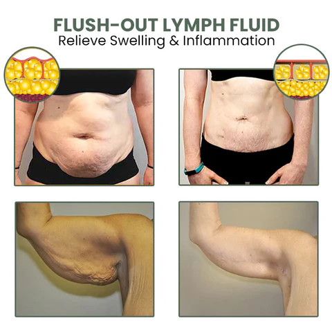 Fivfivgo™ Wermut CelluliteWegMit Hautstraffungscreme