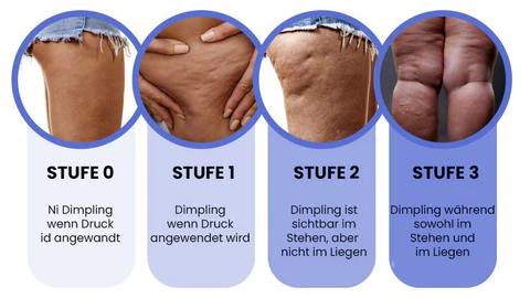 Fivfivgo™ Wermut CelluliteWegMit Hautstraffungscreme