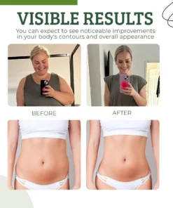 FormFit™ Organic Shaping Patches