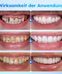 Furzero™ Haifischkollagen Zahnfleischpflege-Gel