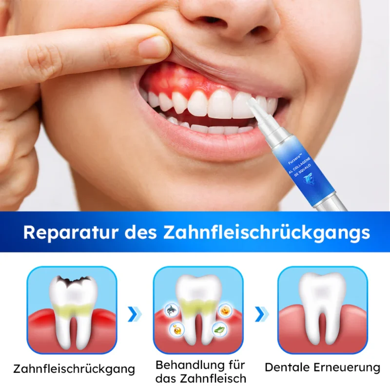 Furzero™ Haifischkollagen Zahnfleischpflege-Gel