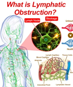 GFOUK™ Bee-venom slimming patch