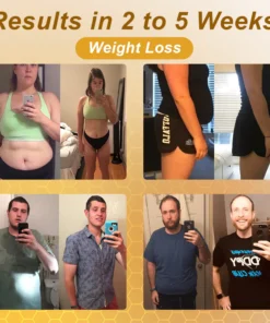 GFOUK™ Bee-venom slimming patch