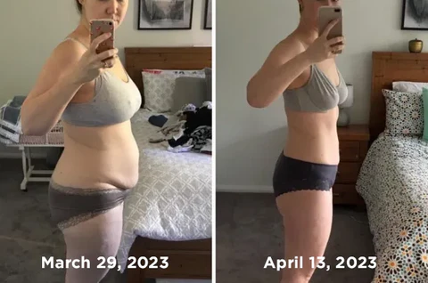 GFOUK™ HexaBurn Bee Venom Toning Spray