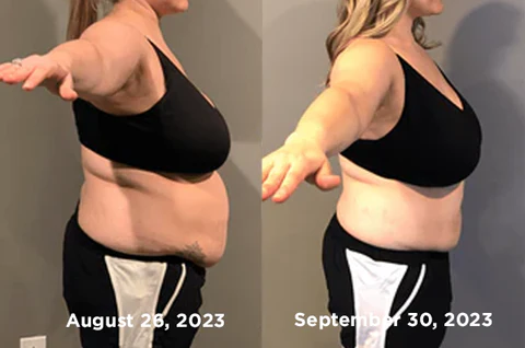 GFOUK™ HexaBurn Bee Venom Toning Spray