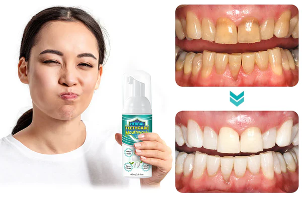 HERBAL TEETHCare Mouthwash 