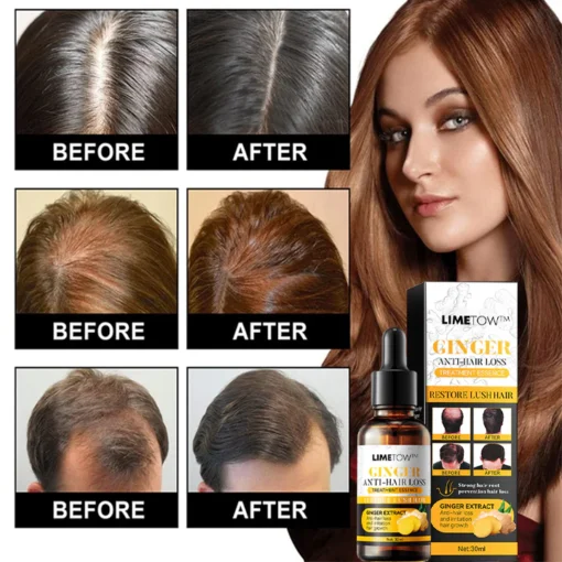 خلاصة علاج LIMETOW™ المضادة لتساقط الشعر