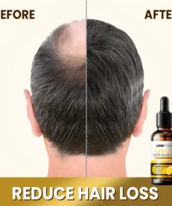 خلاصة علاج LIMETOW™ المضادة لتساقط الشعر