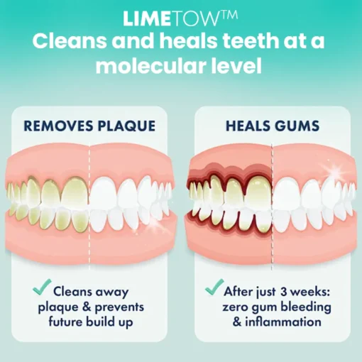 LIMETOW™ زيت سحب جوز الهند والنعناع