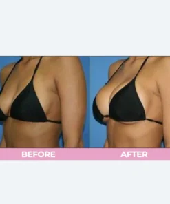 LIMETOW™ Breast Enhance Cream