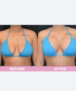 LIMETOW™ Breast Enhance Cream