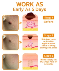 LIMETOW™ DeleTag Bee Venom Treatment Gel