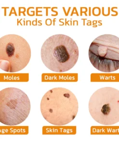 LIMETOW™ DeleTag Bee Venom Treatment Gel