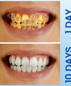 LIMETOW™ Deluxe Herbal Oral Care Mousse