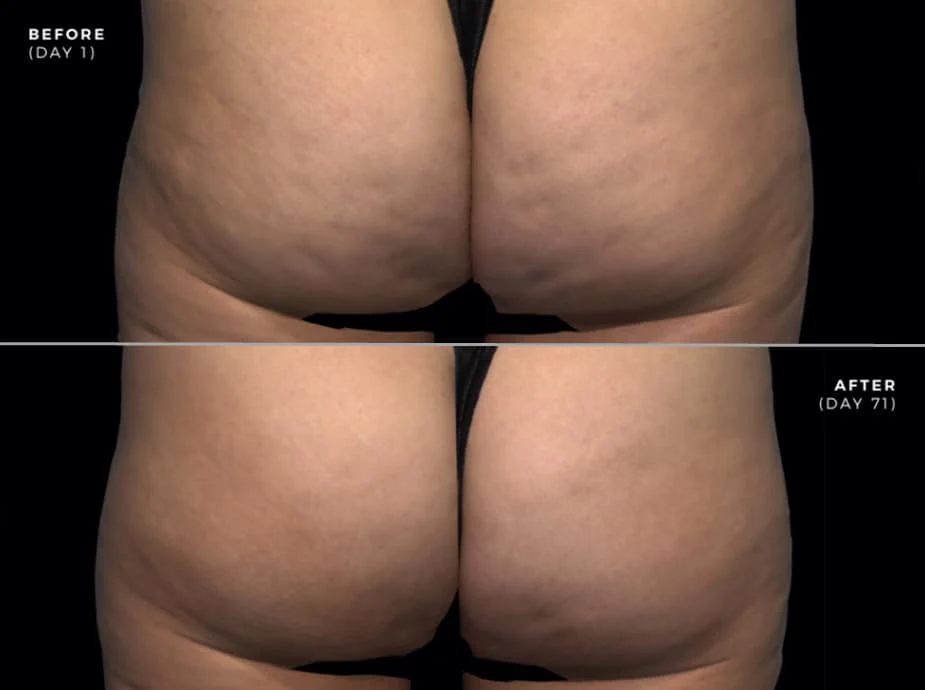 LIMETOW™ Garlic Hip Enlargement Lifting Oil