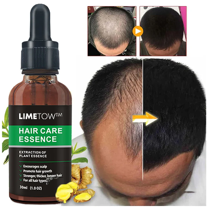 LIMETOW™ Veganic Hair Growth Oil