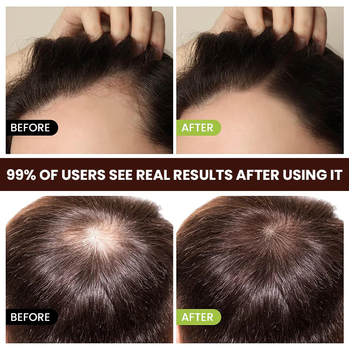 LIMETOW™ Veganic Hair Growth Oil