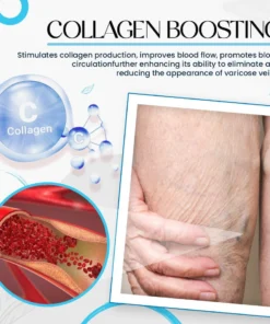 Laura™ Varicose Veins Cream