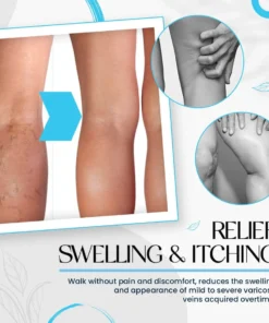 Laura™ Varicose Veins Cream