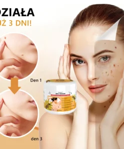 Lenaro™ Krem leczący znamiona i brodawki z jadem pszczelim