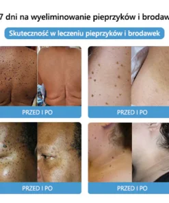 Lenaro™ Krem leczący znamiona i brodawki z jadem pszczelim