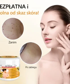 Lenaro™ Krem leczący znamiona i brodawki z jadem pszczelim