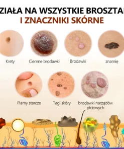 Lenaro™ Krem leczący znamiona i brodawki z jadem pszczelim