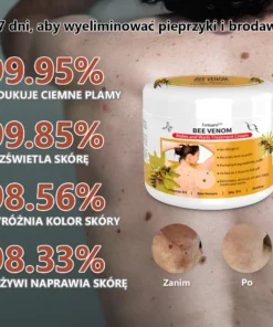 Lenaro™ Krem leczący znamiona i brodawki z jadem pszczelim