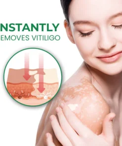 Lovilds™ VitiligoFix تنشيط الإكسير