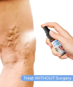 MEDix™ Vein Soothe Max
