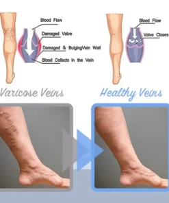MEDix™ Vein Soothe Max