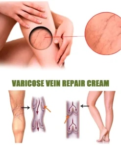 MEDix™ Vein Soothe Max