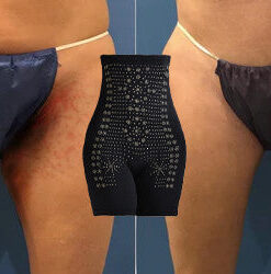 NESLEMY™ Negative Oxygen Ion Fat Burning Tummy Control & Detox Bodysuit