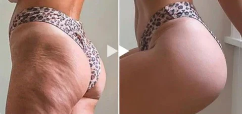 زيت نوربيني™ لشد المؤخرة والثدي