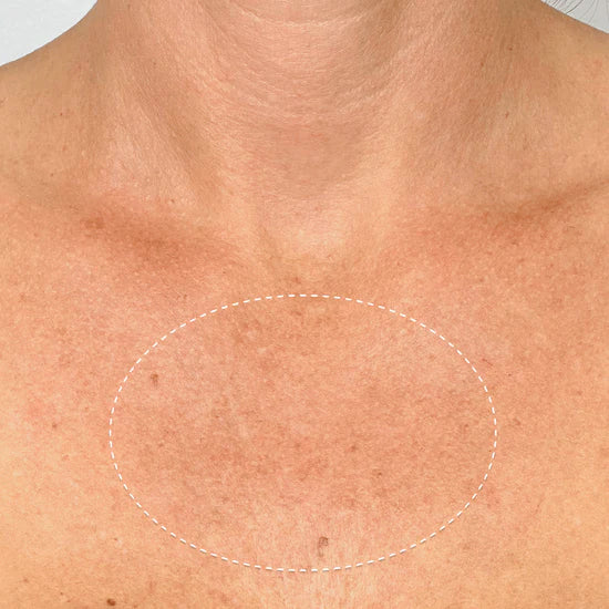 ODEIUN™ Ultra Renewal Retinol Body Cream