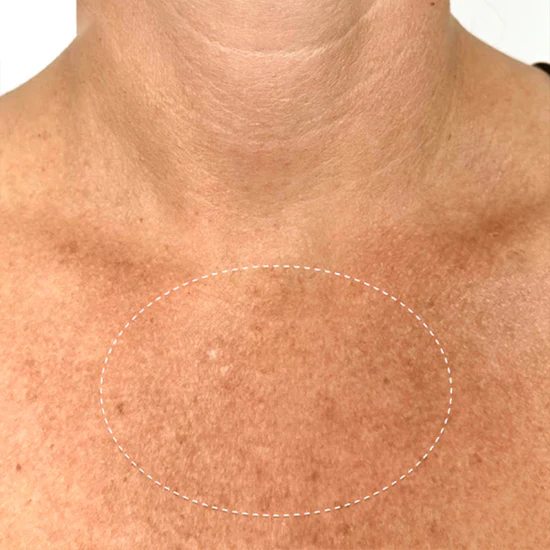 ODEIUN™ Ultra Renewal Retinol Body Cream