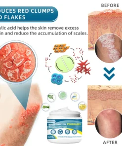 Ourlyard™ Multi-Symptom Psoriasis Treatment Cream