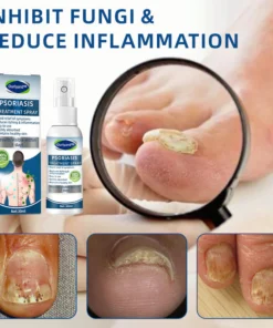 Ourlyard™ Psoriasis Treatment Spray