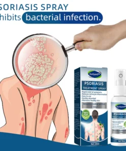 Ourlyard™ Psoriasis Treatment Spray