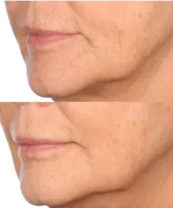 Patented Exclusive Anti-Aging Retinol Capsules