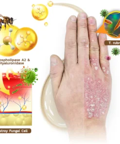 كريم سم النحل AQA™ PsoriX