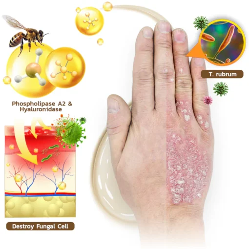 كريم سم النحل AQA™ PsoriX