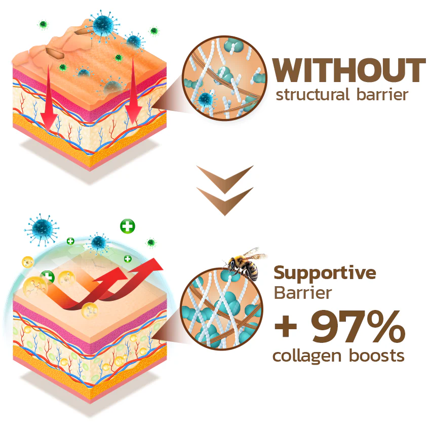 GFOUK™ PsoriX Bee Venom Cream