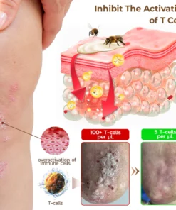 كريم سم النحل AQA™ PsoriX