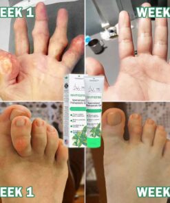 علاج جل المفاصل الاحترافي Seurico™ Cannabidiol