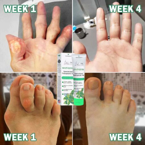 علاج جل المفاصل الاحترافي Seurico™ Cannabidiol
